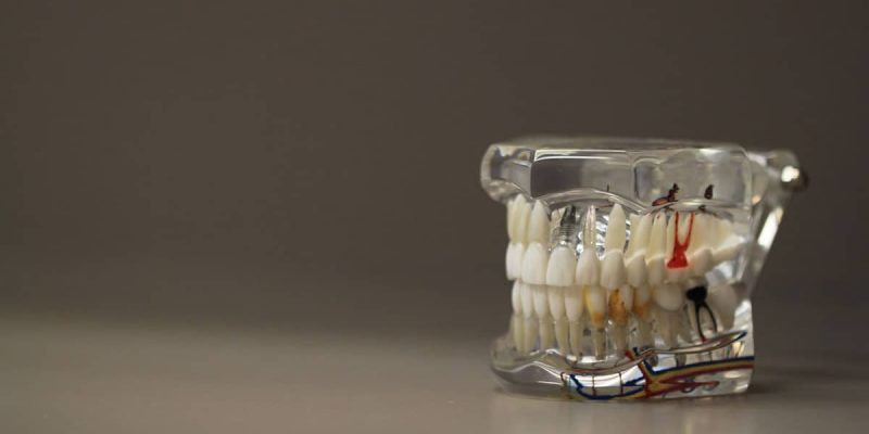Dentistry Teeth Dentures